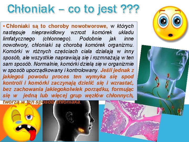 Chłoniak – co to jest ? ? ? § Chłoniaki są to choroby nowotworowe,