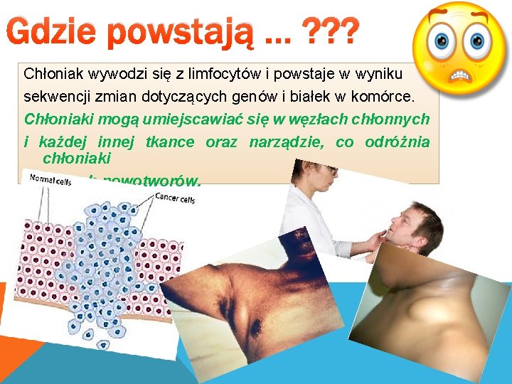 Gdzie powstają … ? ? ? Chłoniak wywodzi się z limfocytów i powstaje w