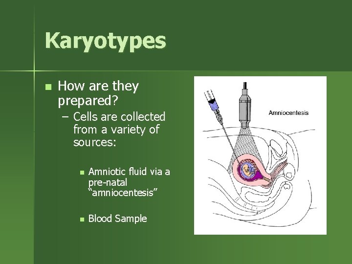 Karyotypes n How are they prepared? – Cells are collected from a variety of
