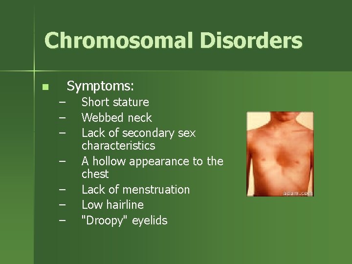 Chromosomal Disorders Symptoms: n – – – – Short stature Webbed neck Lack of