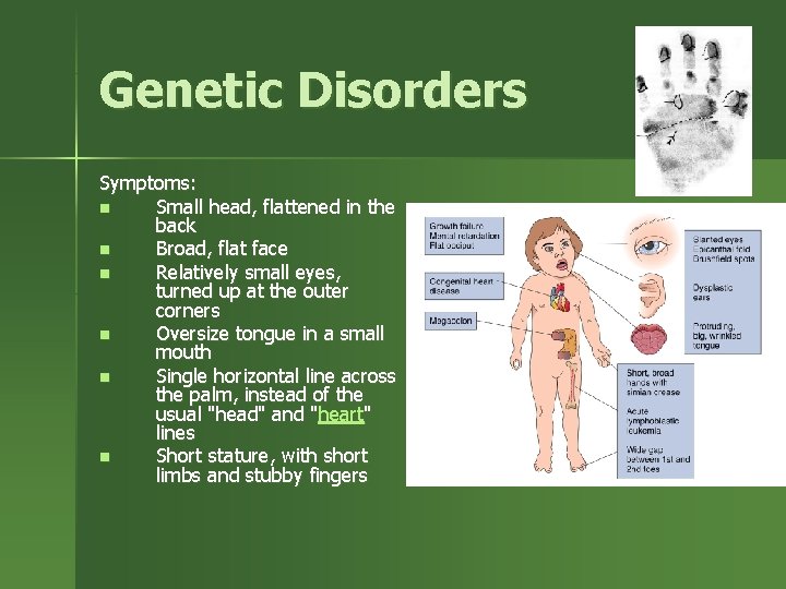 Genetic Disorders Symptoms: n Small head, flattened in the back n Broad, flat face