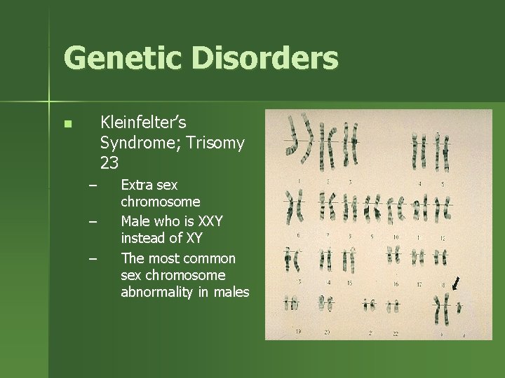Genetic Disorders Kleinfelter’s Syndrome; Trisomy 23 n – – – Extra sex chromosome Male