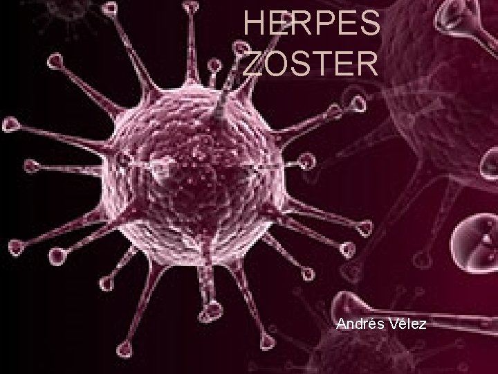 HERPES ZOSTER Andrés Vélez 