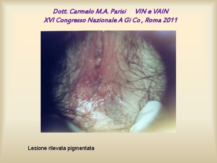 Dott. Carmelo M. A. Parisi VIN e VAIN XVI Congresso Nazionale A Gi Co Dott. Carmelo M. A. Parisi VIN e VAIN XVI Congresso Nazionale A Gi Co