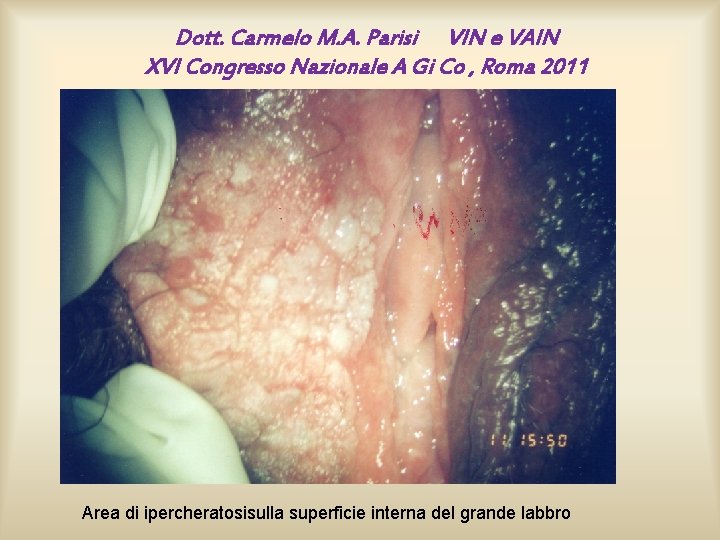 Dott. Carmelo M. A. Parisi VIN e VAIN XVI Congresso Nazionale A Gi Co Dott. Carmelo M. A. Parisi VIN e VAIN XVI Congresso Nazionale A Gi Co