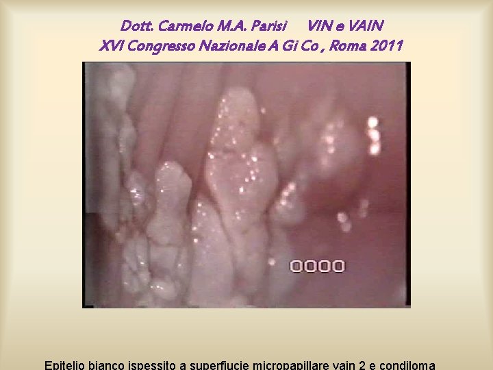 Dott. Carmelo M. A. Parisi VIN e VAIN XVI Congresso Nazionale A Gi Co Dott. Carmelo M. A. Parisi VIN e VAIN XVI Congresso Nazionale A Gi Co