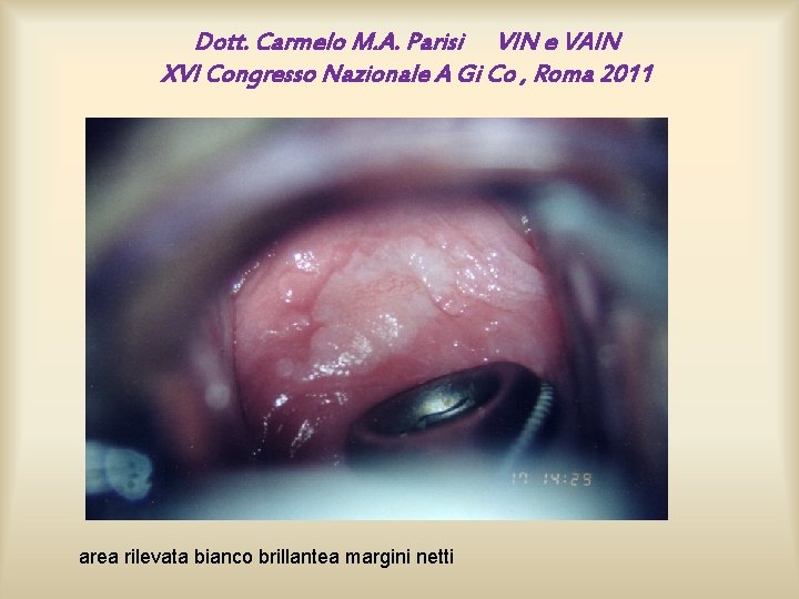 Dott. Carmelo M. A. Parisi VIN e VAIN XVI Congresso Nazionale A Gi Co Dott. Carmelo M. A. Parisi VIN e VAIN XVI Congresso Nazionale A Gi Co