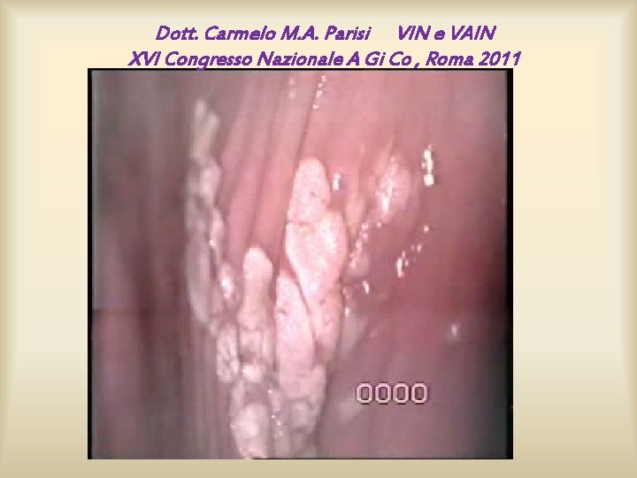 Dott. Carmelo M. A. Parisi VIN e VAIN XVI Congresso Nazionale A Gi Co Dott. Carmelo M. A. Parisi VIN e VAIN XVI Congresso Nazionale A Gi Co