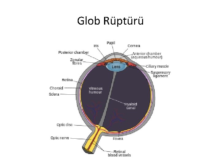 Glob Rüptürü 