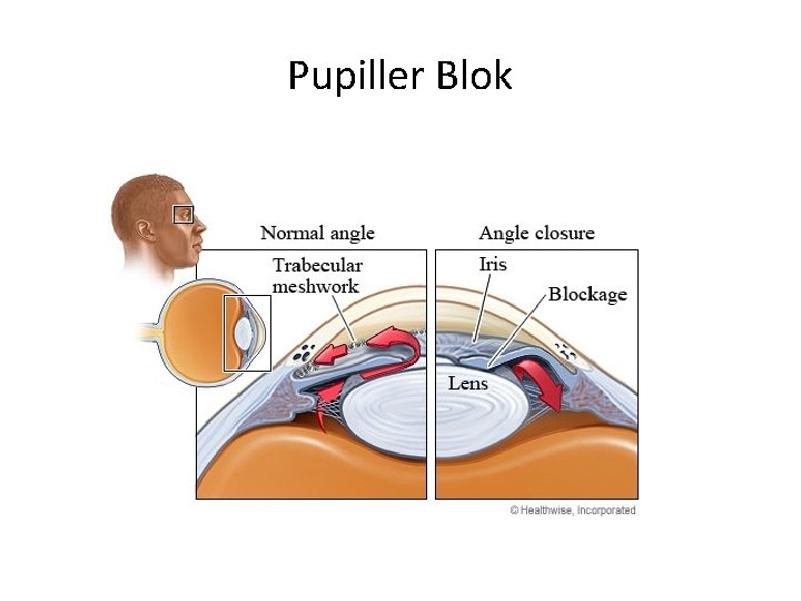 Pupiller Blok 