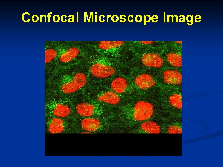 Confocal Microscope Image 