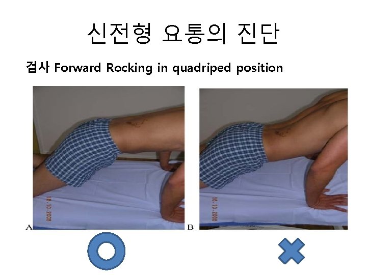 신전형 요통의 진단 검사 Forward Rocking in quadriped position 