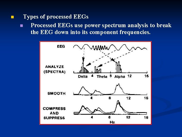  Types of processed EEGs Processed EEGs use power spectrum analysis to break the