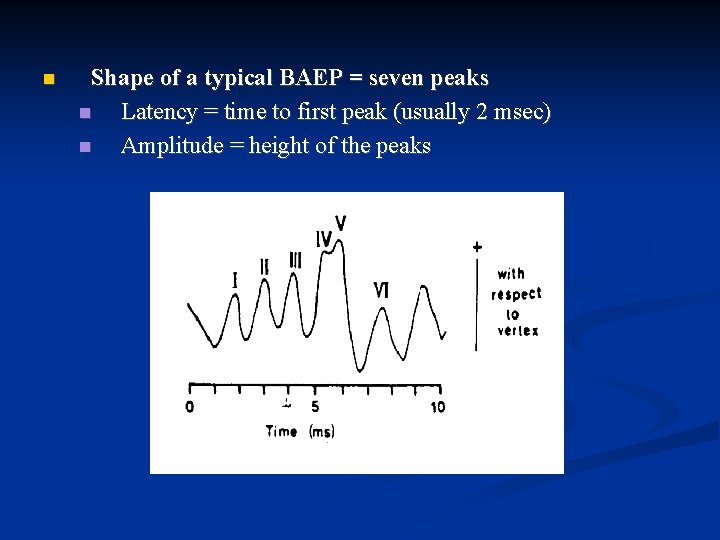  Shape of a typical BAEP = seven peaks Latency = time to first