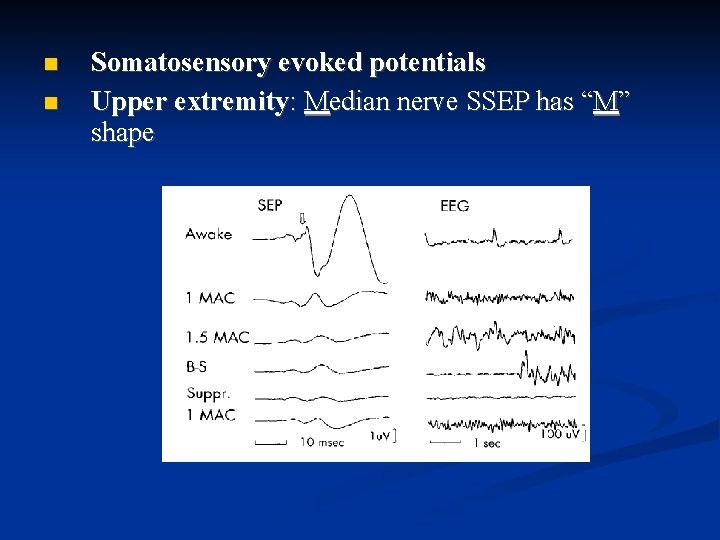  Somatosensory evoked potentials Upper extremity: Median nerve SSEP has “M” shape 