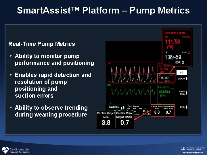 11 Smart. Assist™ Platform – Pump Metrics Real-Time Pump Metrics • Ability to monitor 11 Smart. Assist™ Platform – Pump Metrics Real-Time Pump Metrics • Ability to monitor