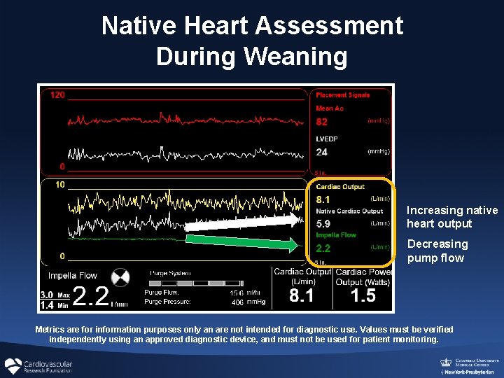 Native Heart Assessment During Weaning Increasing native heart output Decreasing pump flow Metrics are Native Heart Assessment During Weaning Increasing native heart output Decreasing pump flow Metrics are