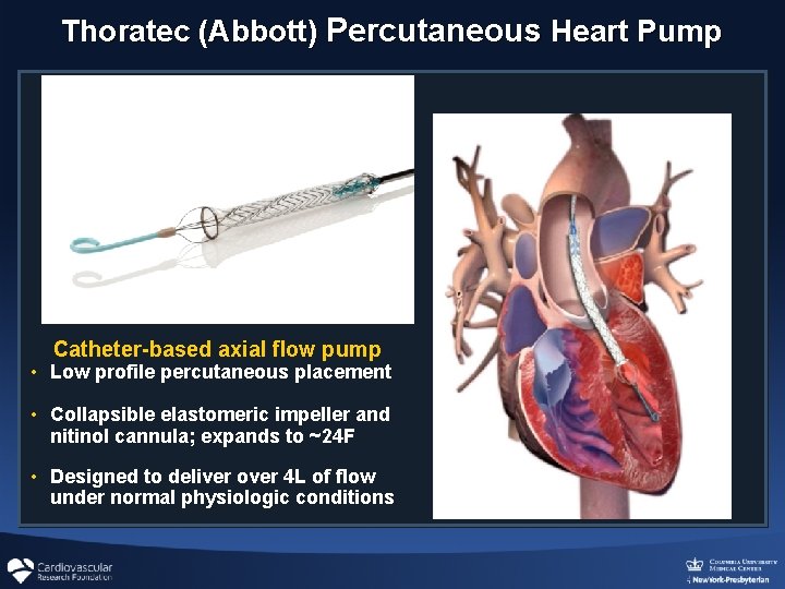 Thoratec (Abbott) Percutaneous Heart Pump Catheter-based axial flow pump • Low profile percutaneous placement Thoratec (Abbott) Percutaneous Heart Pump Catheter-based axial flow pump • Low profile percutaneous placement