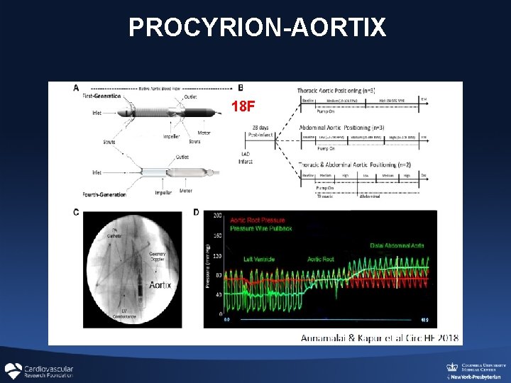 PROCYRION-AORTIX 18 F PROCYRION-AORTIX 18 F