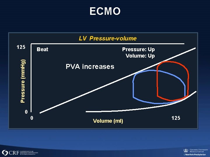 ECMO LV Pressure-volume 125 Pressure: Up Volume: Up Pressure (mm. Hg) Beat PVA increases ECMO LV Pressure-volume 125 Pressure: Up Volume: Up Pressure (mm. Hg) Beat PVA increases