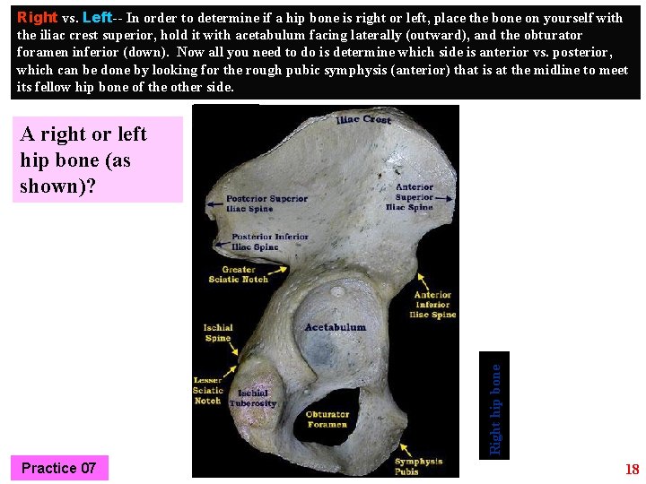 Right vs. Left-- In order to determine if a hip bone is right or