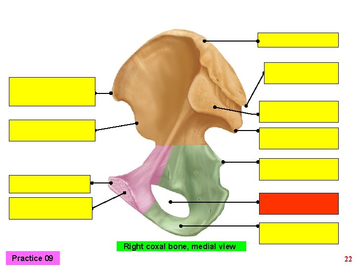 Right coxal bone, medial view Practice 09 22 