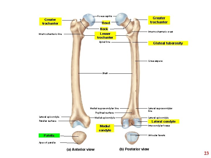 Fovea capitis Greater trochanter Head Neck Lesser trochanter Intertrochanteric line Intertrochanteric crest Spiral line