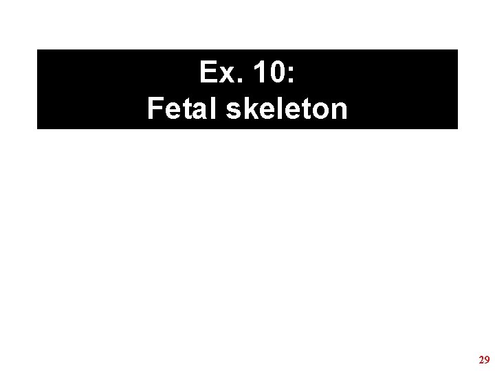 Ex. 10: Fetal skeleton 29 