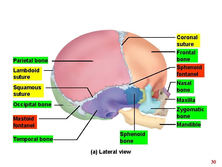 Coronal suture Frontal bone Sphenoid fontanel Parietal bone Lambdoid suture Nasal bone Squamous suture