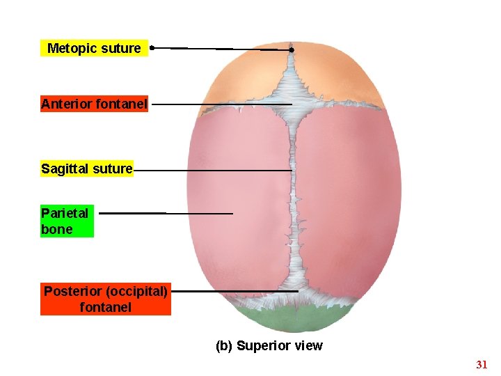 Metopic suture Anterior fontanel Sagittal suture Parietal bone Posterior (occipital) fontanel (b) Superior view