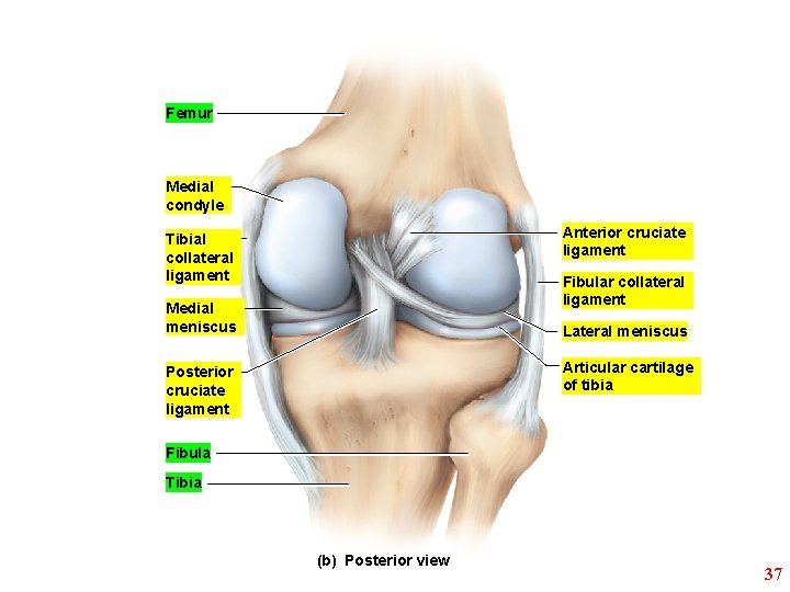 Femur Medial condyle Anterior cruciate ligament Tibial collateral ligament Fibular collateral ligament Medial meniscus