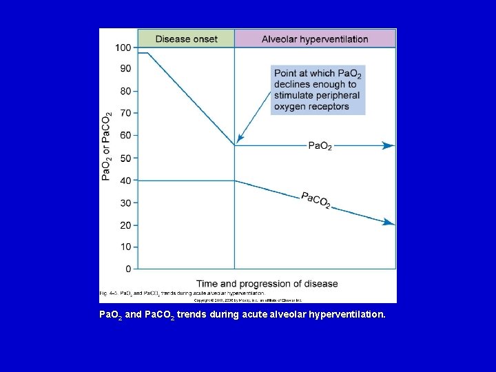 Pa. O 2 and Pa. CO 2 trends during acute alveolar hyperventilation. 