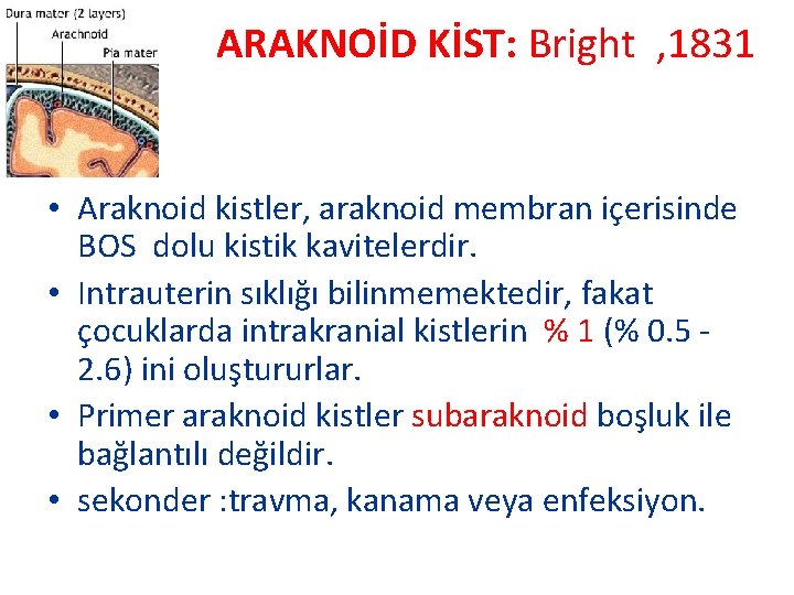 ARAKNOİD KİST: Bright , 1831 • Araknoid kistler, araknoid membran içerisinde BOS dolu kistik