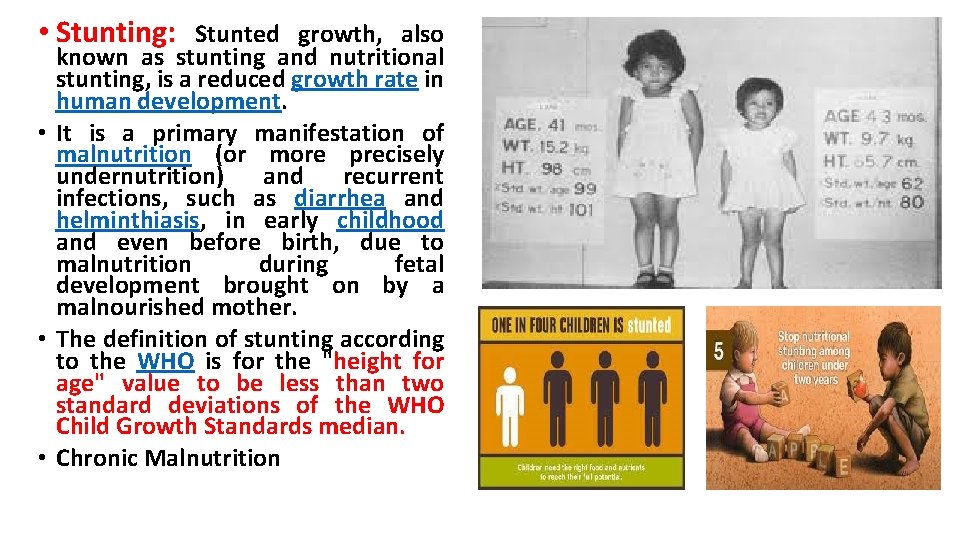  • Stunting: Stunted growth, also known as stunting and nutritional stunting, is a