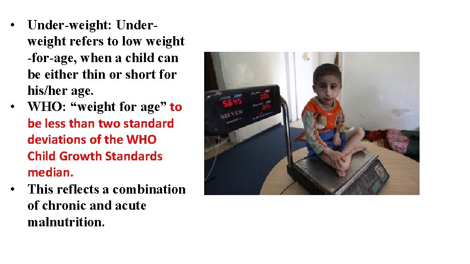  • Under-weight: Underweight refers to low weight -for-age, when a child can be