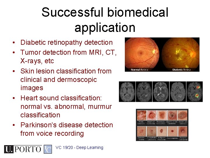 Successful biomedical application • Diabetic retinopathy detection • Tumor detection from MRI, CT, X-rays,