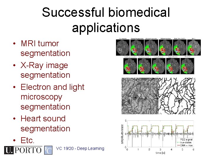 Successful biomedical applications • MRI tumor segmentation • X-Ray image segmentation • Electron and