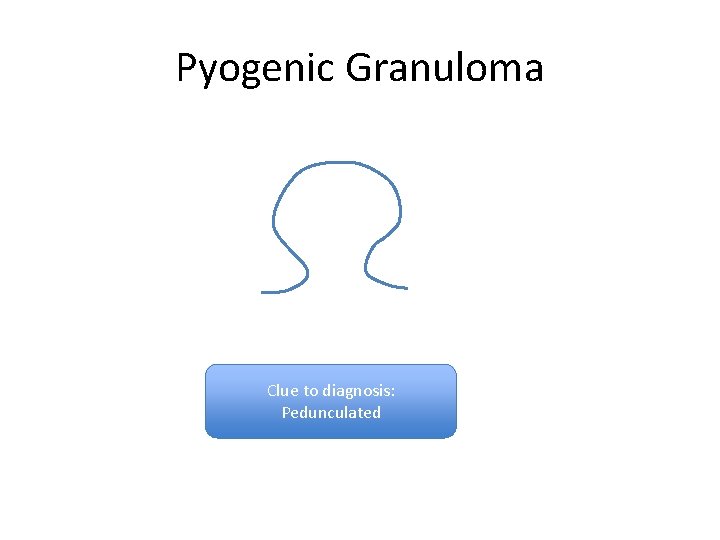 Pyogenic Granuloma Clue to diagnosis: Pedunculated Pyogenic Granuloma Clue to diagnosis: Pedunculated