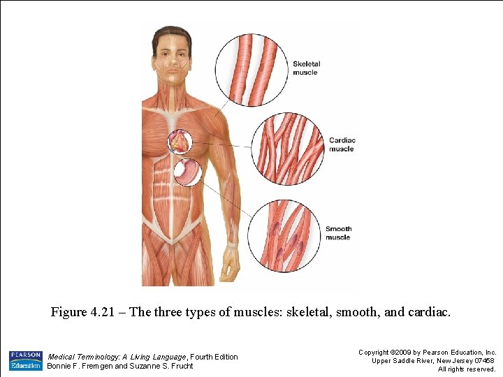 Figure 4. 21 – The three types of muscles: skeletal, smooth, and cardiac. Medical