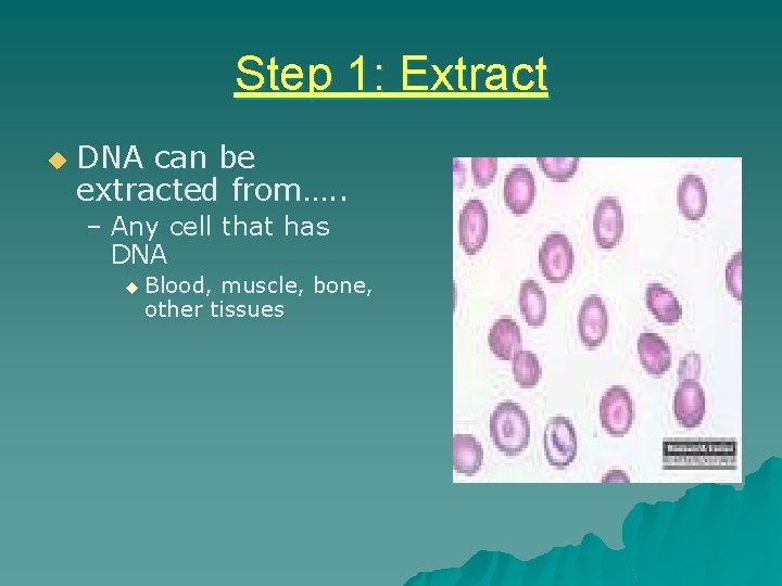 Step 1: Extract u DNA can be extracted from…. . – Any cell that