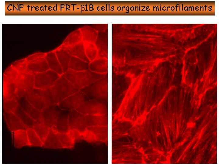 CNF treated FRT- 1 B cells organize microfilaments 