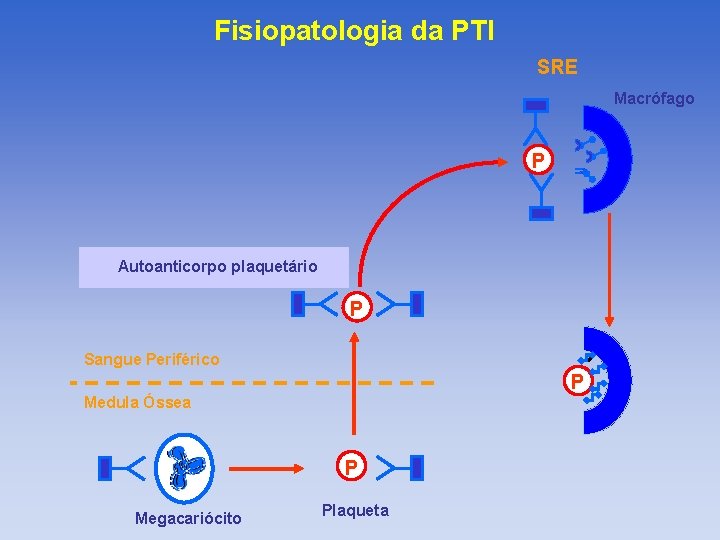 Fisiopatologia da PTI SRE Macrófago P Autoanticorpo plaquetário P Sangue Periférico P Medula Óssea