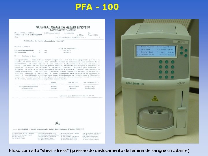 PFA - 100 Fluxo com alto “shear stress” (pressão do deslocamento da lâmina de