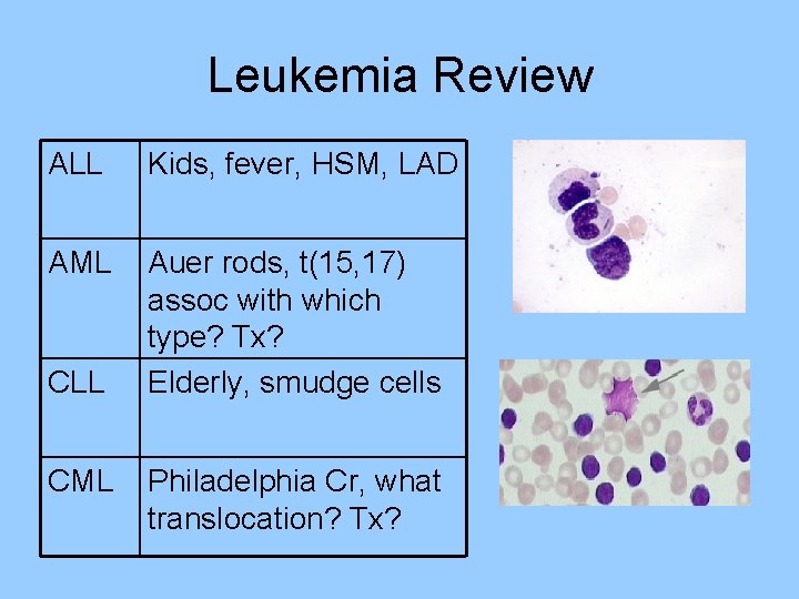 Leukemia Review ALL Kids, fever, HSM, LAD AML Auer rods, t(15, 17) assoc with Leukemia Review ALL Kids, fever, HSM, LAD AML Auer rods, t(15, 17) assoc with