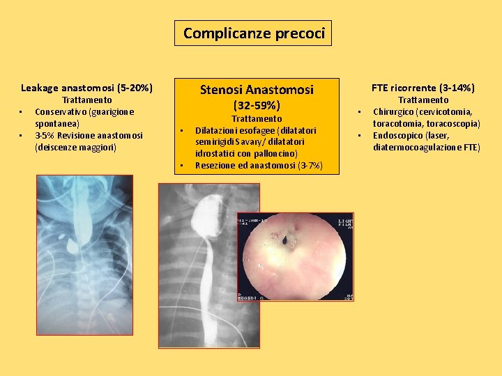 Complicanze precoci Stenosi Anastomosi Leakage anastomosi (5 -20%) • • Trattamento Conservativo (guarigione spontanea)