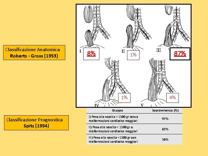 Classificazione Anatomica Roberts - Gross (1953) 8% 87% 1% 1% Gruppo Classificazione Prognostica Spitz