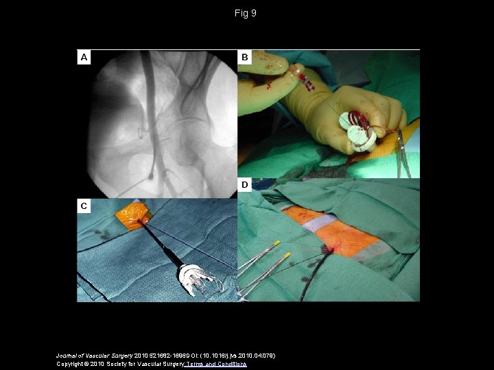 Fig 9 Journal of Vascular Surgery 2010 521682 -1696 DOI: (10. 1016/j. jvs. 2010.