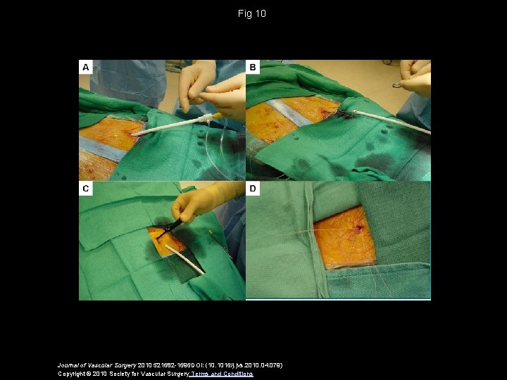 Fig 10 Journal of Vascular Surgery 2010 521682 -1696 DOI: (10. 1016/j. jvs. 2010.