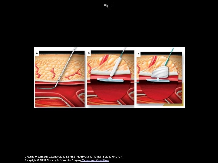 Fig 1 Journal of Vascular Surgery 2010 521682 -1696 DOI: (10. 1016/j. jvs. 2010.