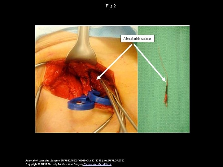 Fig 2 Journal of Vascular Surgery 2010 521682 -1696 DOI: (10. 1016/j. jvs. 2010.